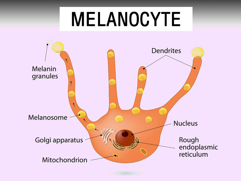 Thâm bẹn do tế bào Melanocytes tạo quá nhiều Melanin