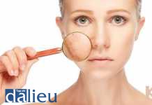 tăng sinh melanin và các chất điều hòa tính hiệu mới trong điều trị nám