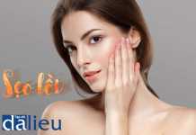 Sẹo lồi là gì?