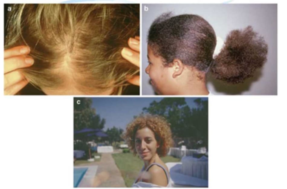 Fig. 7.30 Three volume problems: (a) not enough, (b) too much, and (c) managing curls