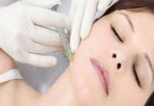 Lịch sử, cách phân loại và những đặc tính của filler