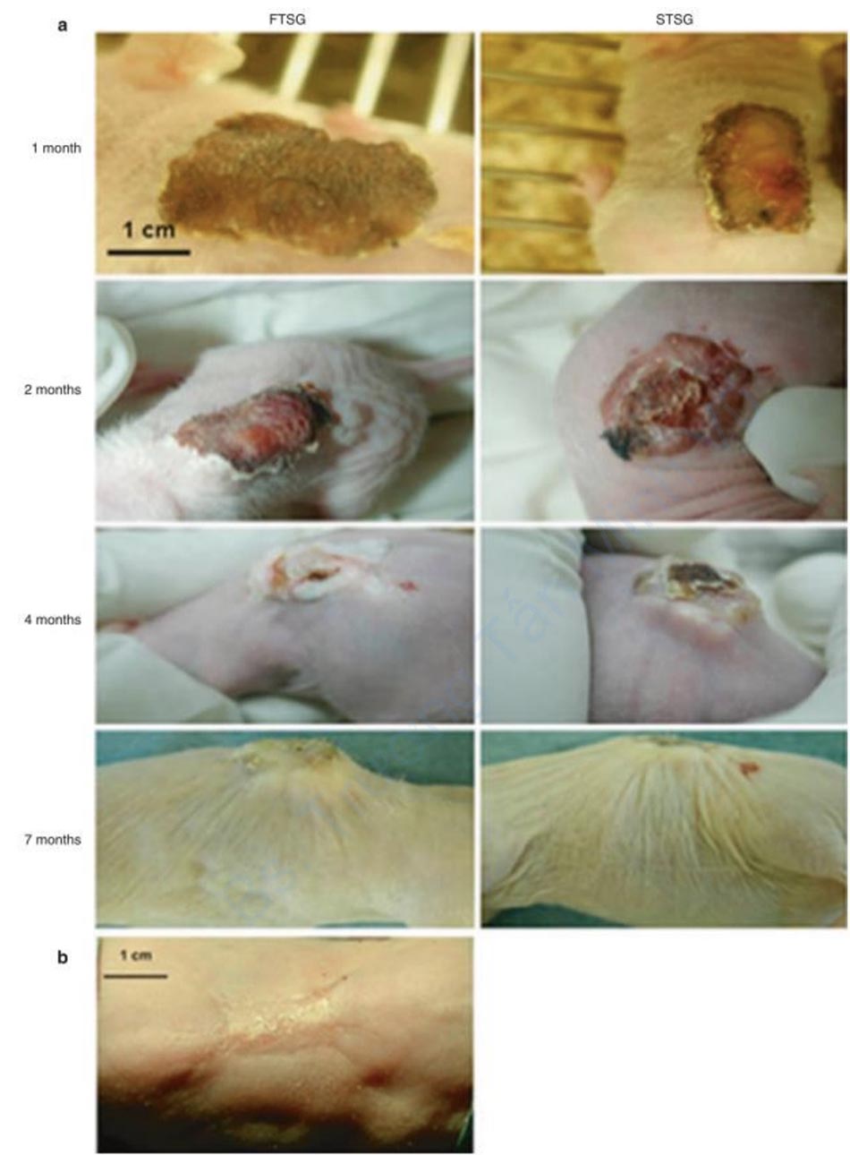 Hình 3.10 Cả mảnh ghép da người có độ dày đầy đủ (FTSG) và độ dày tách lớp (STSG) đều được ghép vào lưng của con chuột nude và sự tiến triển của sự hình thành sẹo được ghi lại vào thời điểm 1 tháng, 2 tháng, 4 tháng và 7 tháng sau ghép (a). Mảnh da chuột cũng được ghép tuy nhiên không hình thành sẹo (b) [133].