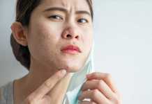 Mụn và môi trường