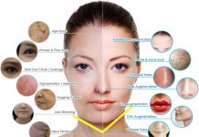 TIẾP CẬN TRẺ HOÁ VÙNG MẶT